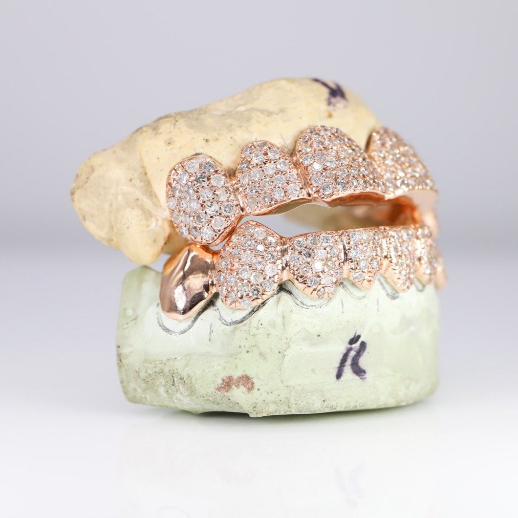 Iced Out Zig Zag Set Grillz Gulf Coast Jewelz