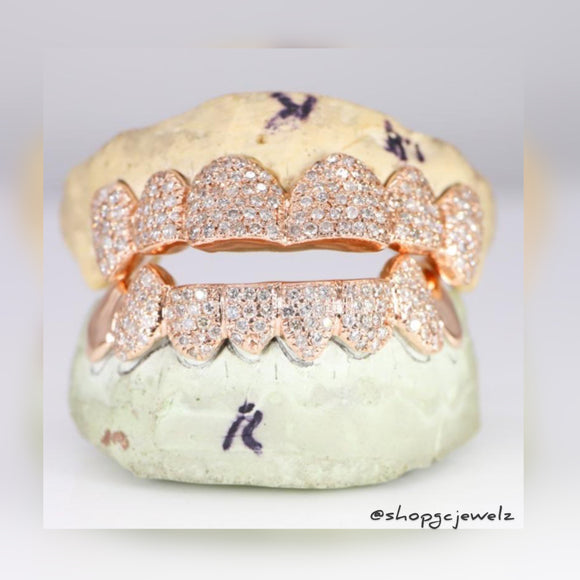 Iced Out Zig Zag Set Grillz