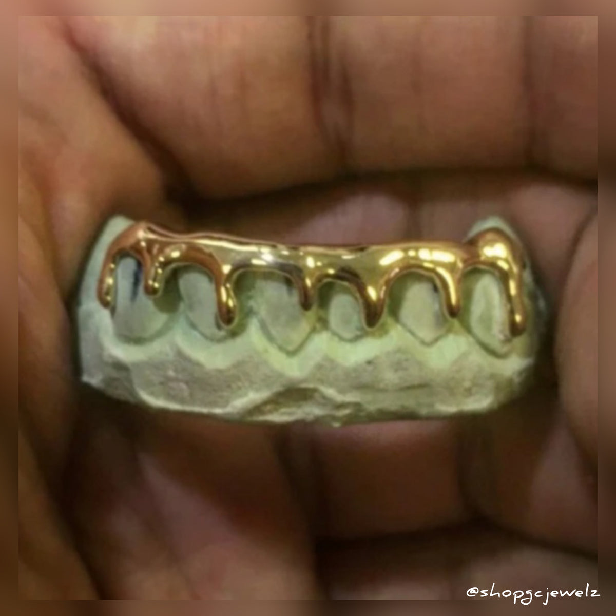 Thick Drip Gold Grillz Gulf Coast Jewelz