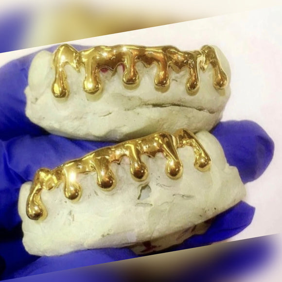 Thick Drip Gold Grillz